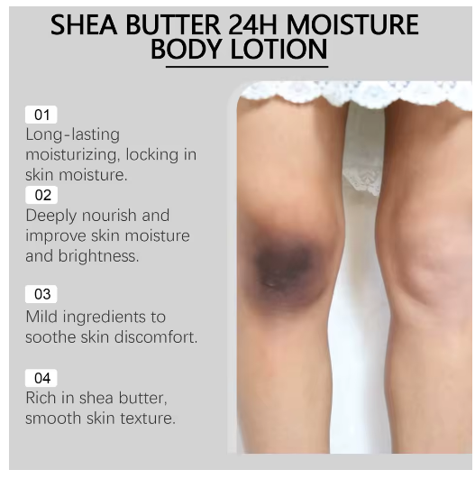 Shea Butter Body Lotion – 24‑Hour Moisturizing